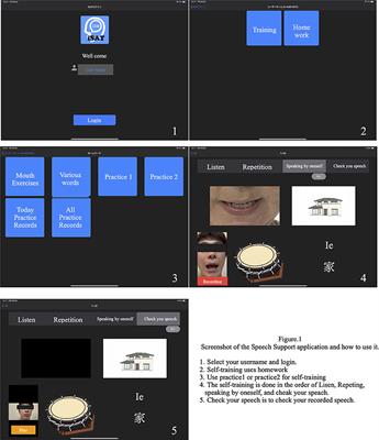 Effects of a new speech support application on intensive speech therapy and changes in functional brain connectivity in patients with post-stroke aphasia